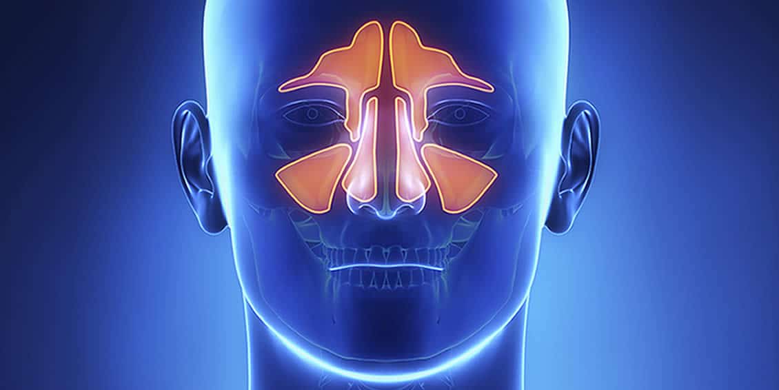 Michael Setzen Otolaryngology, PC great neck, manhattan: Balloon Sinus Dilation