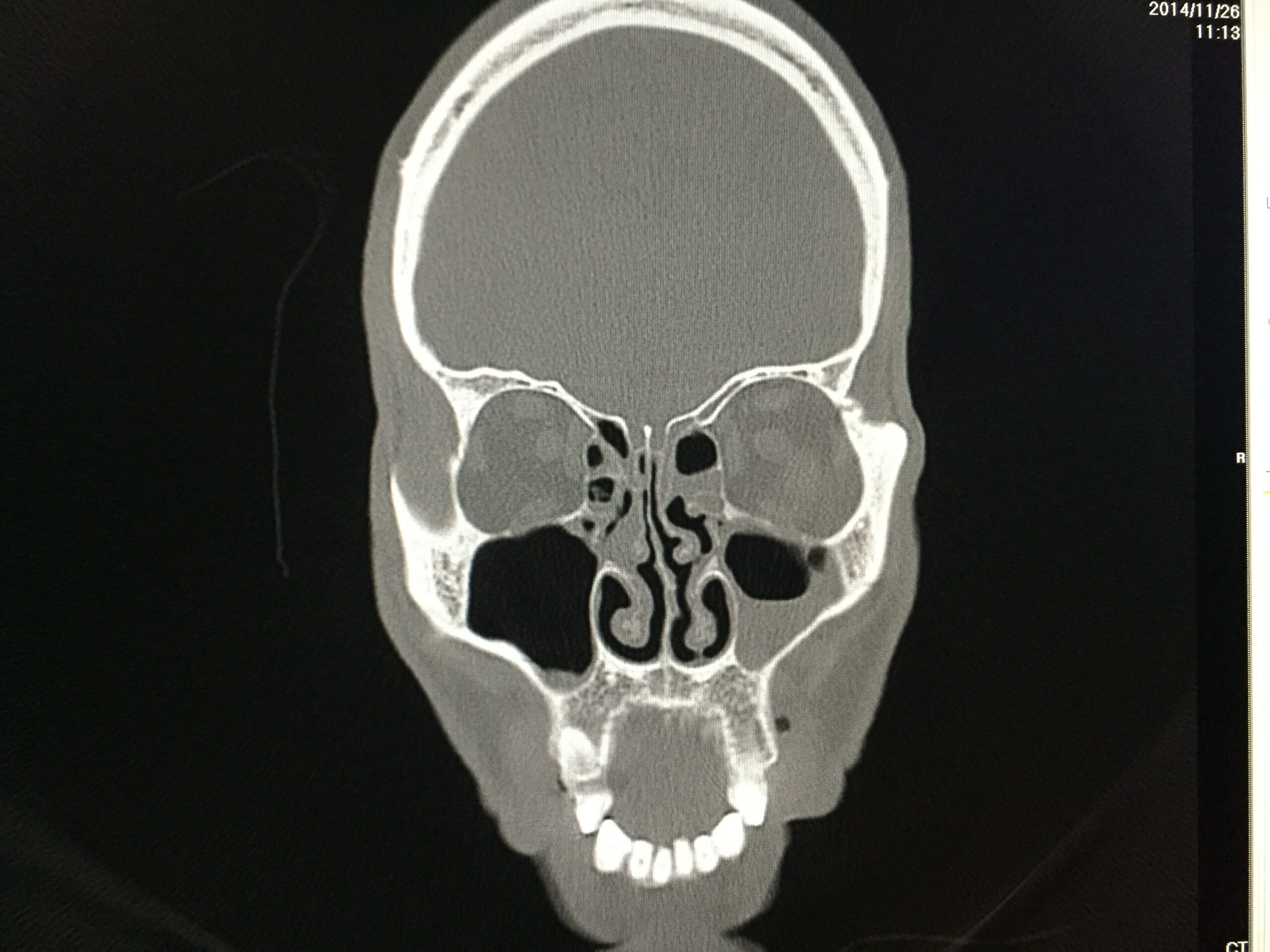 Michael Setzen Otolaryngology, PC great neck, manhattan: Essential paths to life after residency 